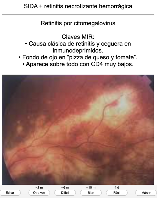 👁️ Ankis patogMIRmónicos Oftalmología