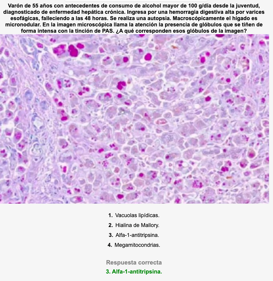 🧠 Pack Completo simulANKIS MIR 2017-2026