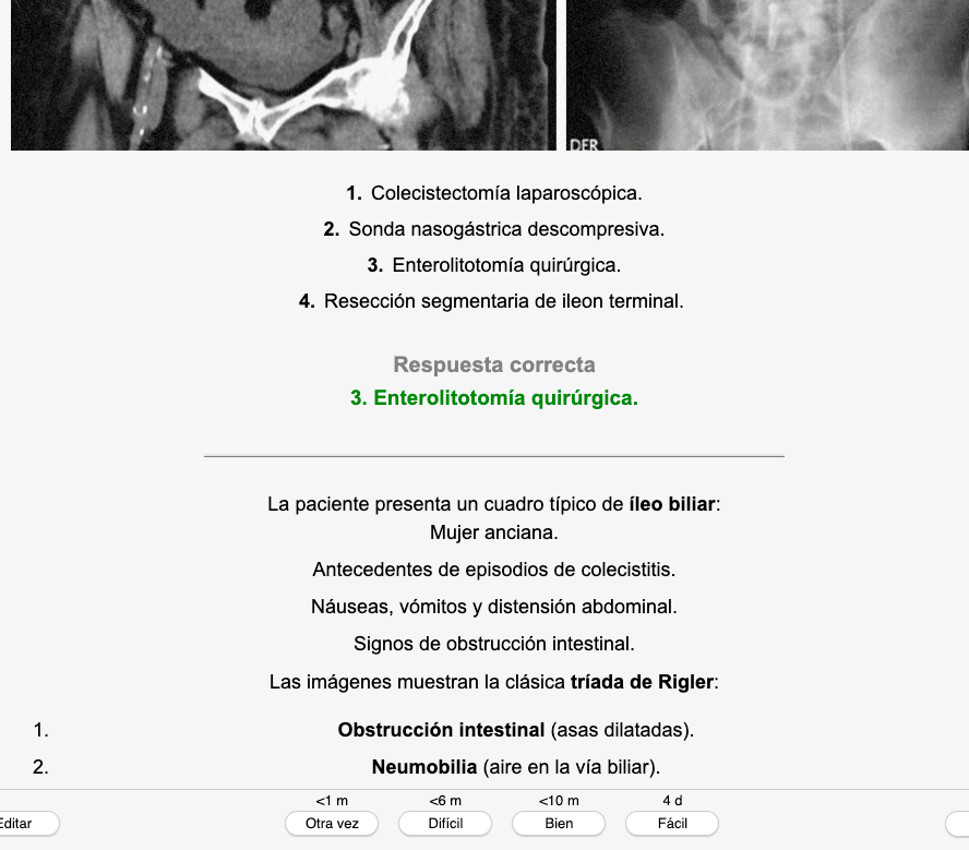 📝 simulANKIS MIR 2020