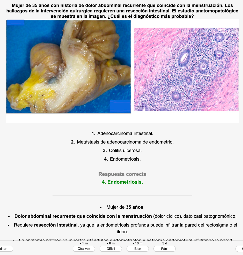 🧠 Pack Completo simulANKIS MIR 2017-2026