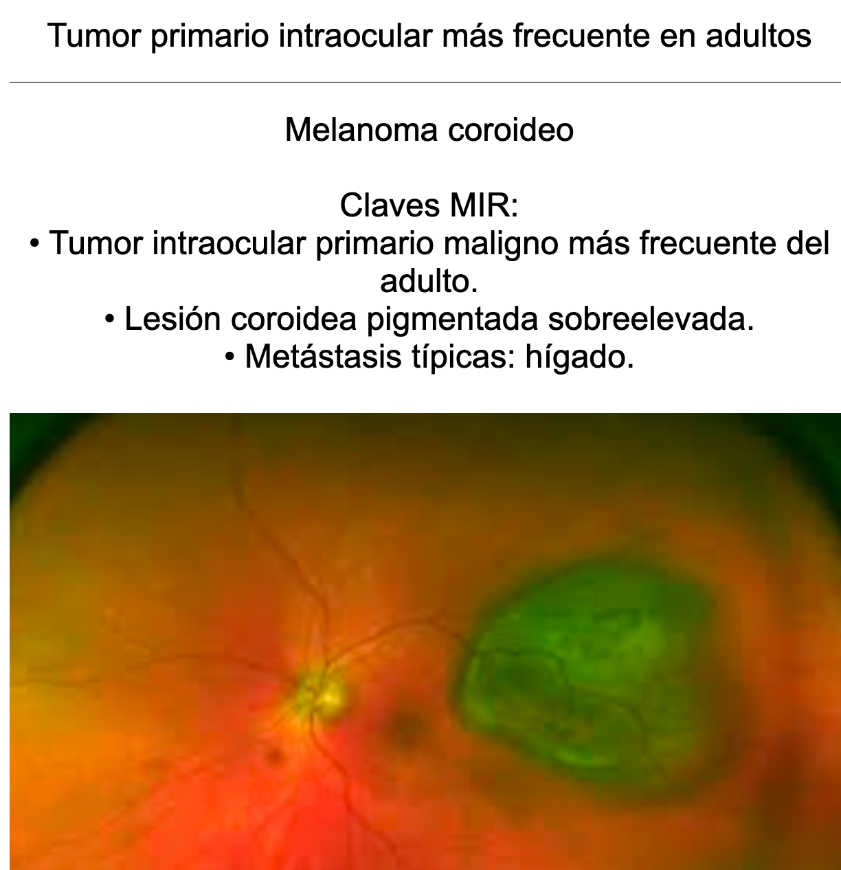 👁️ Ankis patogMIRmónicos Oftalmología